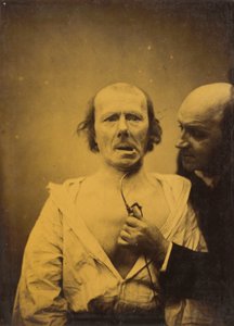 Diese Kontraktion des M. platysma allein fehlt Ausdruck von Guillaume Benjamin Amant Duchenne