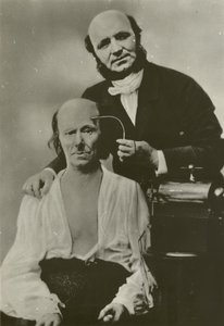 Französischer Neurologe Duchenne de Boulogne benutzt sein Elektrophysiologie-Apparat an einem alten Mann von Guillaume Benjamin Armand Duchenne de Boulogne