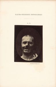 Elektro-Physiologie Fotografisch, Figur 53 von Guillaume Benjamin Duchenne