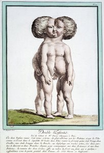 Siamesische Kinder - in „Les deviations de la nature“ von Régnault von Jean Baptiste Regnault