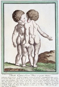 Siamesische Kinder - in „Die Abweichungen der Natur“ von Régnault von Jean Baptiste Regnault