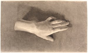 Studie einer Gips-Hand