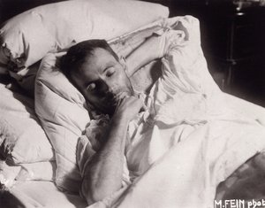 Egon Schiele auf seinem Sterbebett, 1918 von Martha Fein