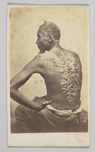 Gordon bei der medizinischen Untersuchung, 1863 von McPherson and Oliver