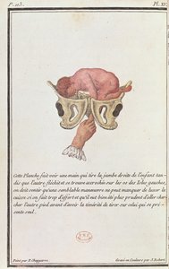 Querschnittsdiagramm eines Babys, das am Arm aus dem Mutterleib gezogen wird, aus einem Buch von Madame Angelique Le Boursier du Coudray, graviert von J. Robert, 1783