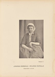 Zerebrale Atrophie: Partielle Epilepsie, linke Hemiplegie von Paul Marie Léon Regnard