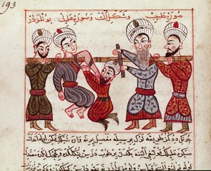 Medizin: orthopädischer Eingriff. Miniatur aus einer türkischen Medizinabschrift von Charaf-ed-din (1404-1468) nach „La Chirurgie Imperiale“ (Ms Sup Turk 693 fol. 193) 1466 Paris, B.N. von Persian School
