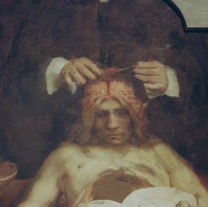 Die Anatomie des Dr. Johan Deijman von Rembrandt van Rijn