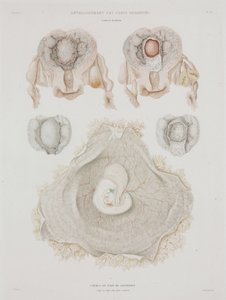 Gynäkologie: Menschliche Gebärmutter mit Embryo, ca. 1847-1859 von John Pardon