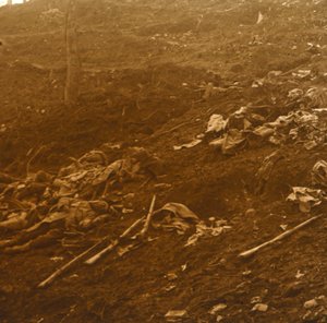 Nach dem Angriff, Les Éparges, Nordfrankreich, 1915