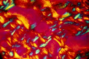 Biomaterialien, LM Knochen