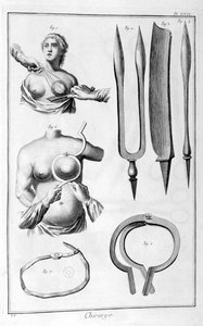 Brustoperation, 1751-1777
