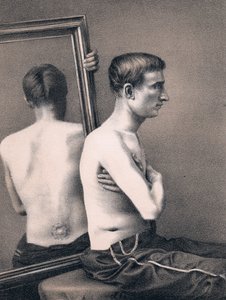 Genesung eines Verwundeten mit Bauchschuss, Amerikanischer Bürgerkrieg