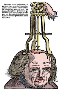 Trepanation von Unbekannt