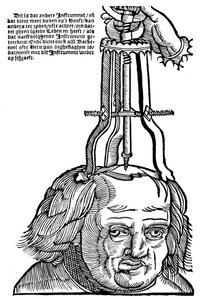 Trepanation, 1593
