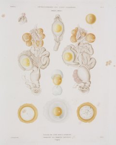 Hühnerei im Eileiter, ca. 1847-1859