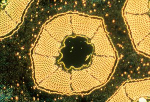 Tieftemperatursupraleiter, Lichtmikrograph