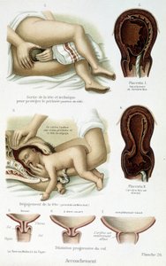 Geburt - wissenschaftliche Tafel, Ende des 19. Jahrhunderts von Unknown artist