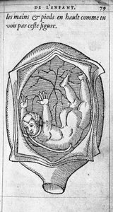 Die Position des Fötus im Uterus während der Schwangerschaft. Gravur aus „De la generation des enfants“ von dem französischen Arzt und Chirurgen Ambroise Paré (1509-1590) 16. Jahrhundert