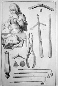 Trepanation des Schädels, verschiedene Instrumente (Gravur) von Unknown artist