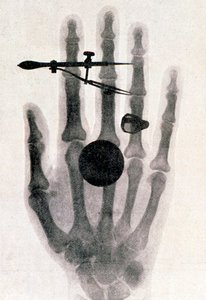 Wilhelm Roentgens Röntgenaufnahme der Hand seiner Frau, 1896