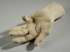Abguss einer Hand