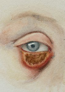 Augen