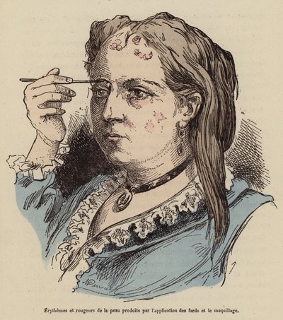 Frau mit Hautausschlägen und Rötungen durch die Verwendung von Make-up von (after) French School