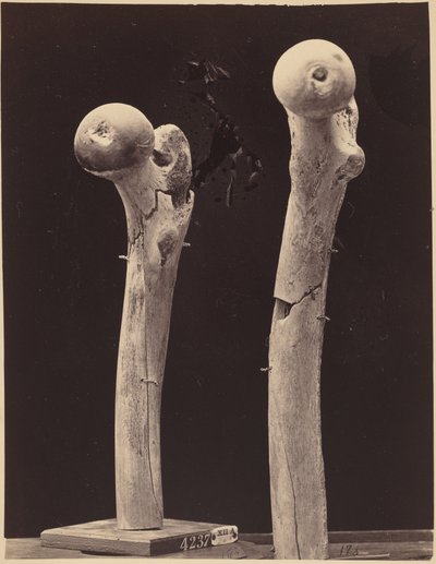 Beispiele von Schussfrakturen des Oberschenkelknochens von American Photographer