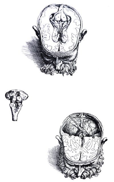 Die Platten aus dem siebten Buch der De Humani Corporis Fabrica von Andreas Vesalius