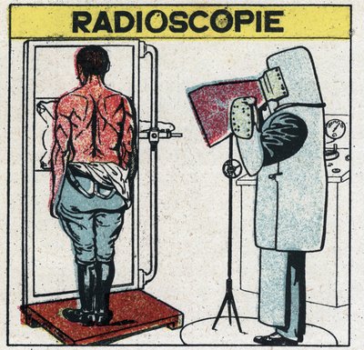 Röntgenstrahlen: Radioskopie eines menschlichen Körpers. Der Radiologe schützt sich vor Röntgenstrahlen, indem er ein Gummituch mit einer Gummilösung, die Bleisalze enthält, trägt. Sein Kopf ist mit einer Kappe bedeckt und seine Hände mit Handschuhen aus d von Anonymous Anonymous