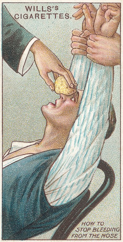 Wie man Nasenbluten stoppt, Nr. 31 aus der Erste-Hilfe-Serie von Willss Zigarettenkarten, 1913 von English School