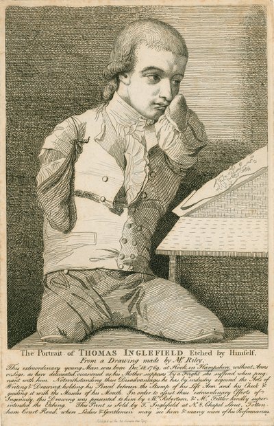 Thomas Inglefield, geboren am 18. Dezember 1769 in Hook, Hampshire, ohne Arme oder Beine von English School