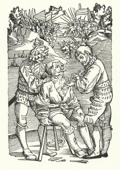 Behandlung eines verwundeten Soldaten auf dem Schlachtfeld (Gravur) von German School