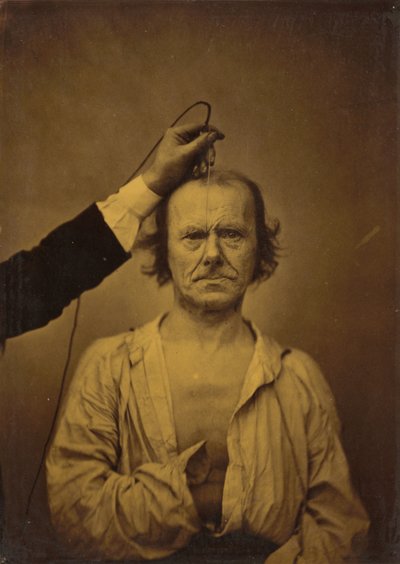 Aufmerksamkeit (links); Strenge, Aggression (rechts) von Guillaume-Benjamin-Armand Duchenne de Boulogne
