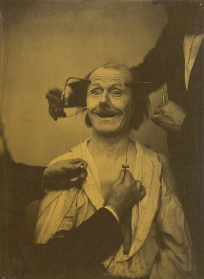 Ein falscher, unvollständiger Ausdruck von angenehmer Überraschung oder Bewunderung von Guillaume Benjamin Amant Duchenne