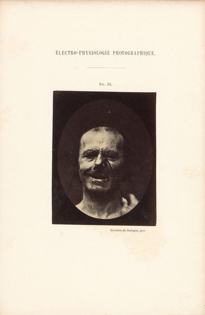 Elektro-Physiologie Fotografisch, Figur 53 von Guillaume Benjamin Duchenne
