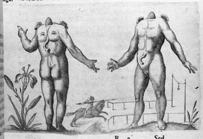 Verschiedene Arten von menschlichen Monstern: ein Mann ohne Kopf. Gravur aus „De monstrorum natura, causis et differentiis“ von Fortunio Liceti (1577-1656), italienischer Wissenschaftler. 1646 von Italian School