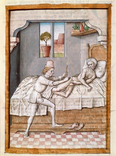 Ein Arzt behandelt einen Patienten (Miniatur aus einer deutschen Übersetzung der Fabeln von „Kalila und Dimna“ von Bidpai, um 1480) von Unknown artist