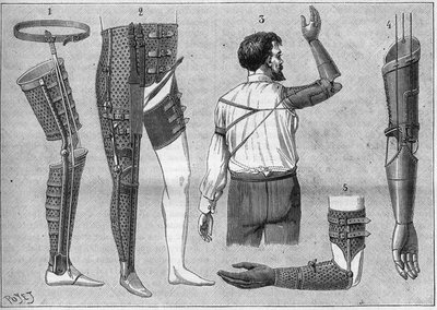 Moderne Apparate für Amputierte. 1) Künstliches Bein mit Gürtel, 2) Apparat für die Oberschenkelgelenke, 3 und 4 künstliche Arme, erfunden und gebaut von M.L Matthieu für den verstorbenen Roger, 5) künstlicher Arm mit Hand, Daumen und Zeigefinger. In „La n von Unknown artist
