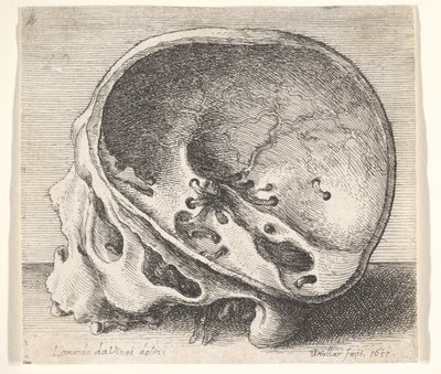 Sektionierter Schädel im Profil nach links mit entferntem linken Schädelteil von Wenceslaus Hollar