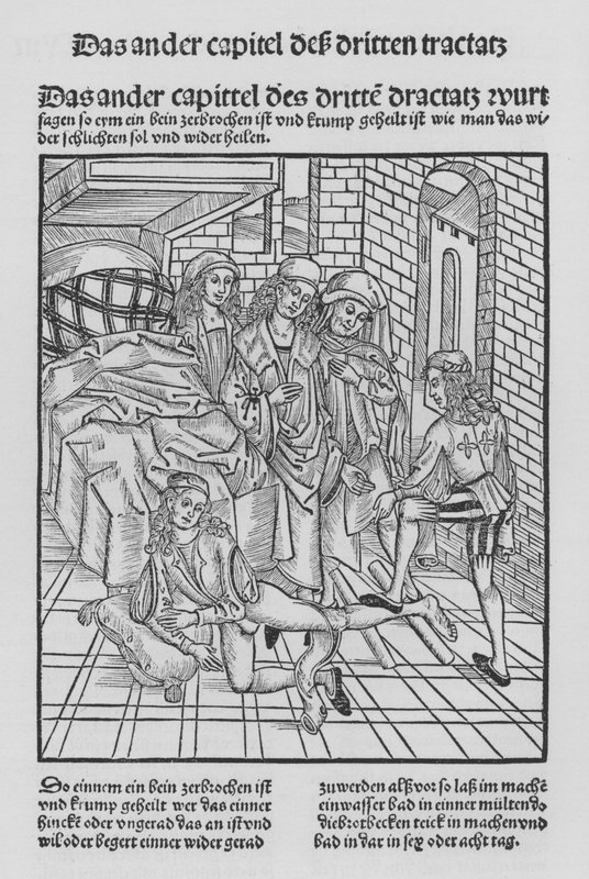 Das Buch der Chirurgie von Hieronymus Brunschwig von (after) German School