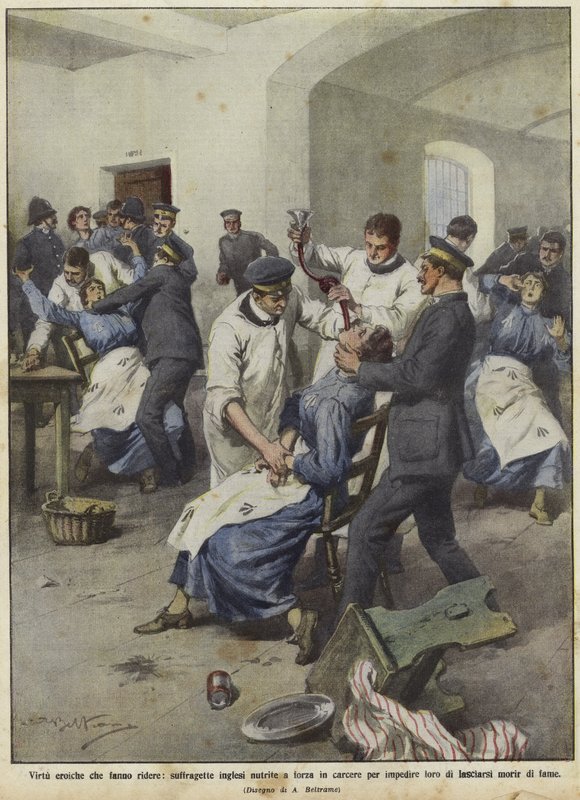 Britische Suffragetten werden in Gefängnissen zwangsernährt von Achille Beltrame