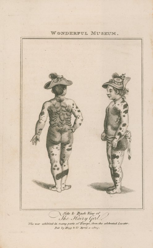 Seiten- und Rückansicht des haarigen Mädchens von English School