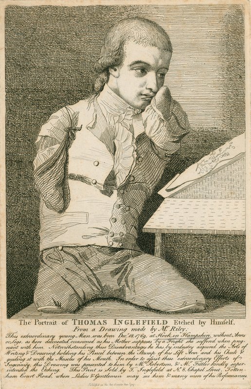 Thomas Inglefield, geboren am 18. Dezember 1769 in Hook, Hampshire, ohne Arme oder Beine von English School