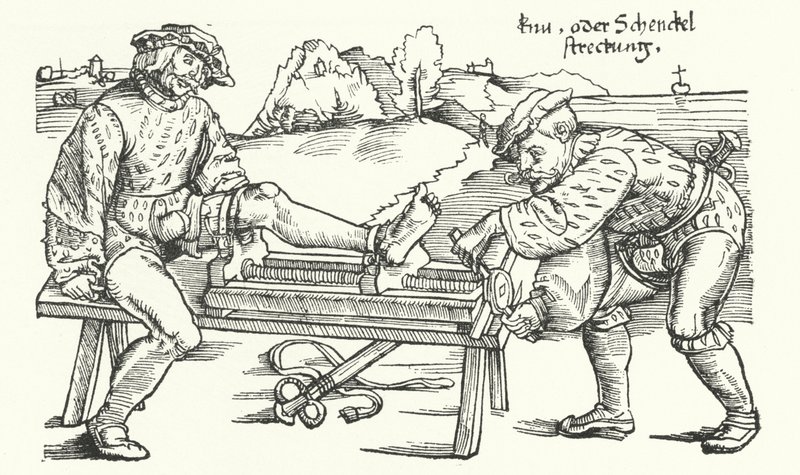 Gerät zum Richten eines verletzten Beins (Gravur) von German School
