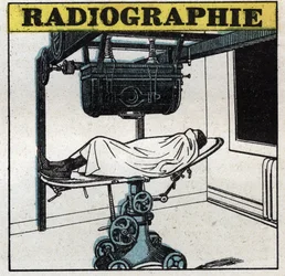Röntgenstrahlen: Röntgengerät. Anonyme Illustration von 1925. Private Sammlung.