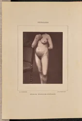 Generalisierte vesikulöse Syphilis