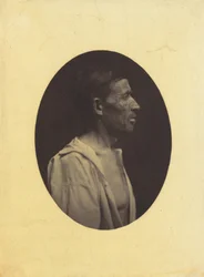 Ein Porträt, im Profil gesehen, eines 42-jährigen Mannes, betäubt durch Alkoholmissbrauch..., 1854-1856