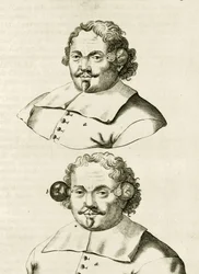 Ein Beispiel für Schröpfen, aus Exercitationes Practicae circa Medendi Methodum von Frederik Dekkers, 1694